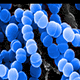 Close-up microscopic image showing clusters of round blue bacteria against a dark background.